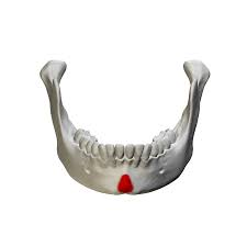 of the mandible 