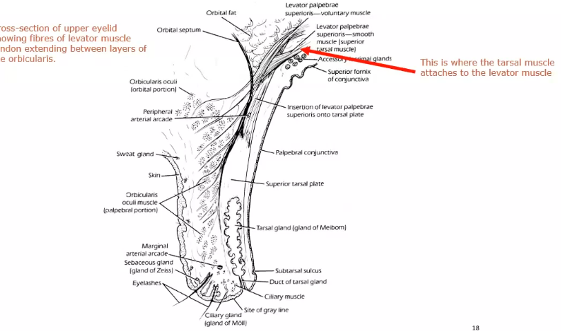 <p>levator palpebrae superiosis muscle (levator muscke)</p>