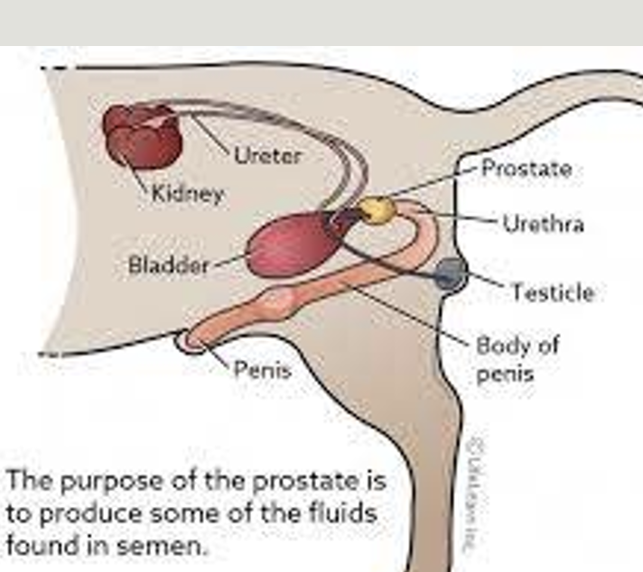 <p>prostatic enlargement </p>