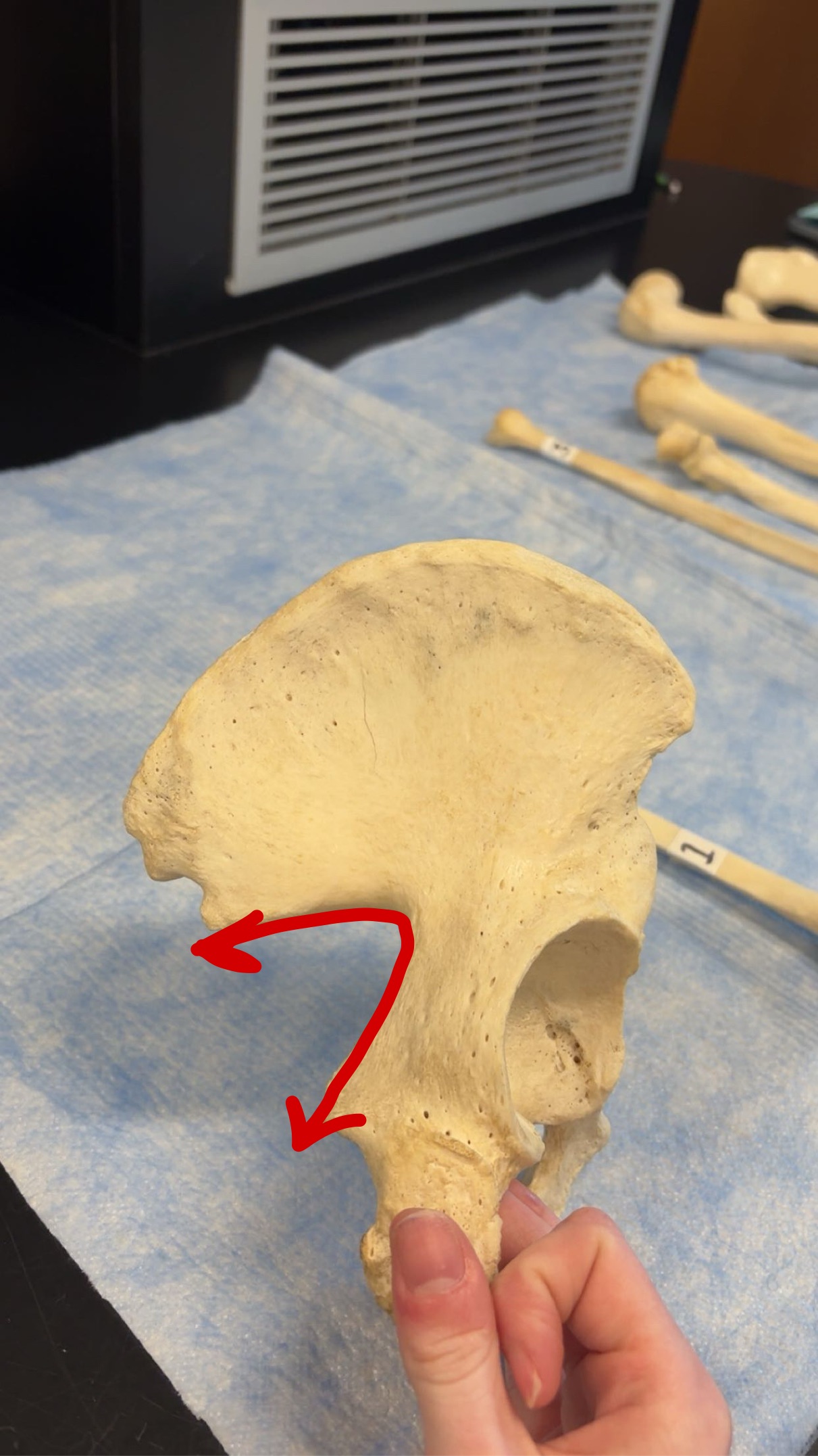 <p>Name this structure</p>