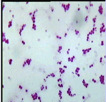 Gram stained slides of… 