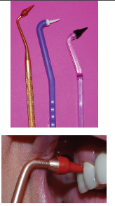 <p><strong>• Primarily for gingival massage/gingival stimulation of blood flow </strong></p><p><strong>Can be used to shape interproximal area during healing after surgery </strong></p><p><strong>Cleaning debris form indertendal area</strong></p><p><strong>Biofilm removal at and below gingival margin </strong></p><p><strong>• Contraindicated for healthy gingiva</strong></p>