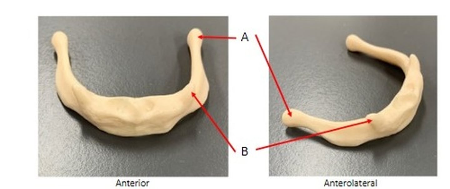 <p>Identify</p>