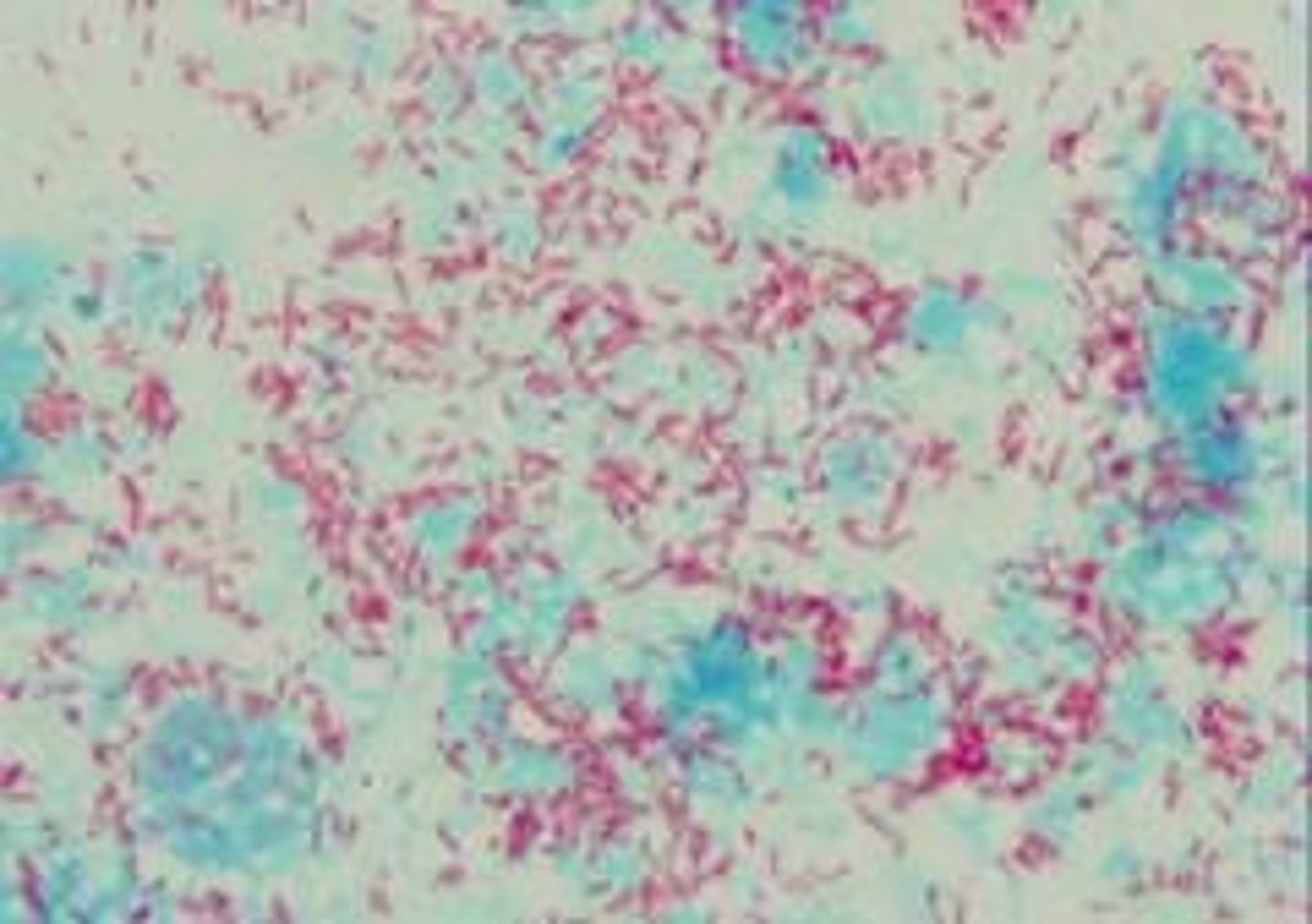 <p>To differentiate between Gram-positive (purple/blue) and Gram-negative (pink) bacteria.</p>