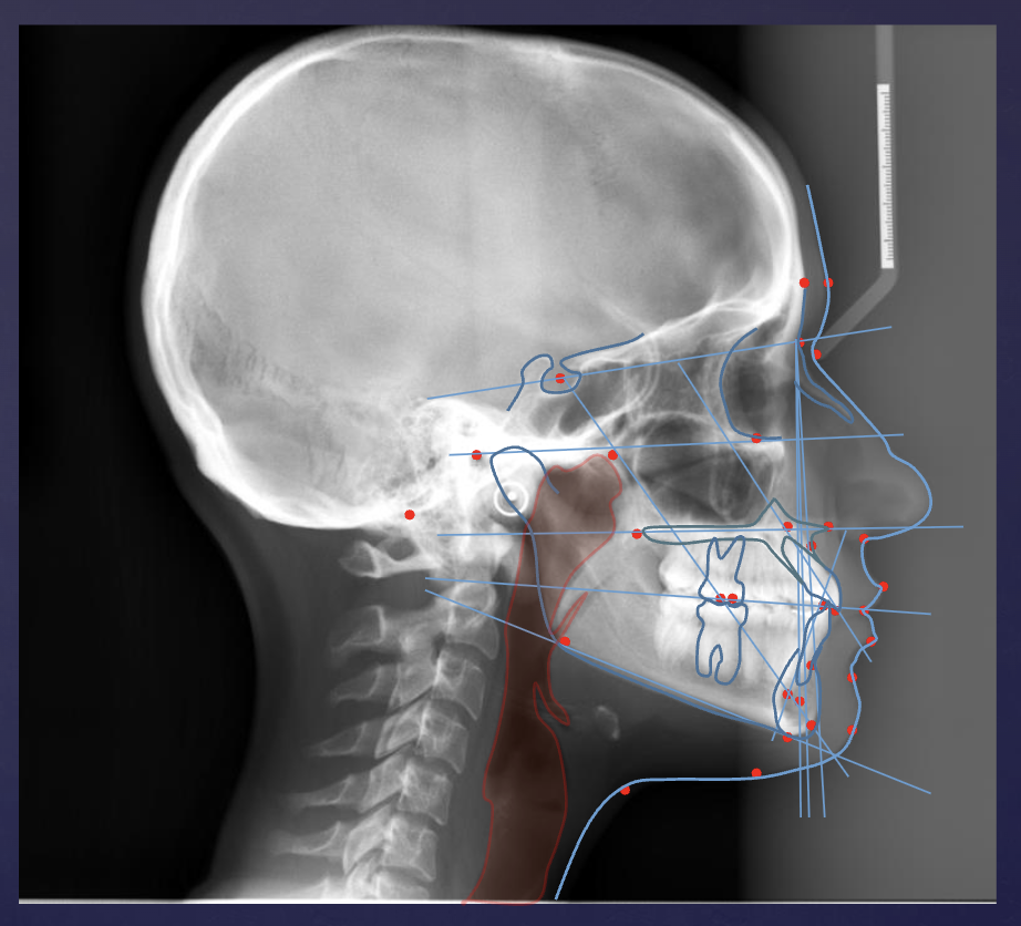 <ul><li><p>orthodontics (cephalometric analysis)</p></li><li><p>survey of skull/facial bones (trauma, disease, developmental abnormality)</p></li><li><p>assessment of nasopharyngeal soft tissues, paranasal sinuses</p></li></ul><p></p>