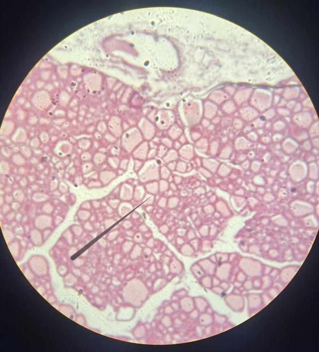 <p>Identify the tissue and mention one site</p>