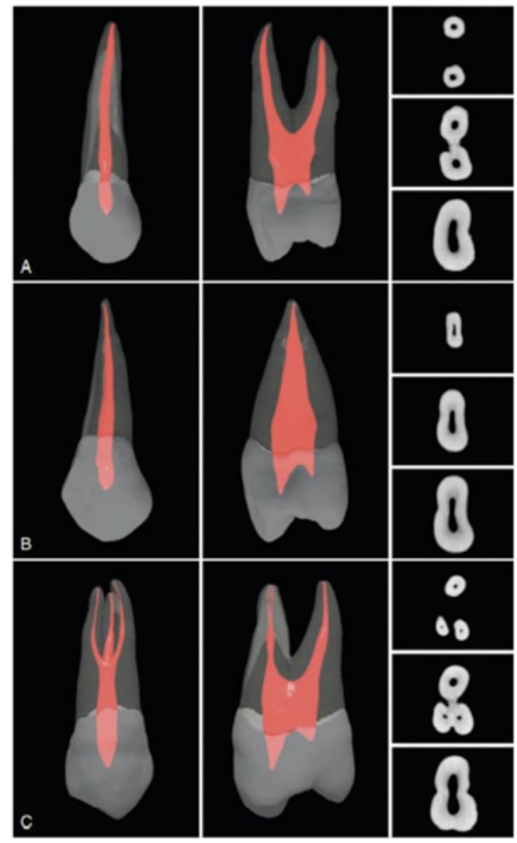 <p>1/2</p>