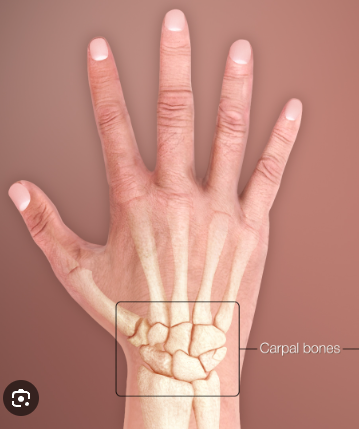 <p>distal, as it’s closer to the body’s point of attachment (forearm) than the hand. Referring to the wrist, particularly the group of small bones in the wrist known as carpal bones.</p>