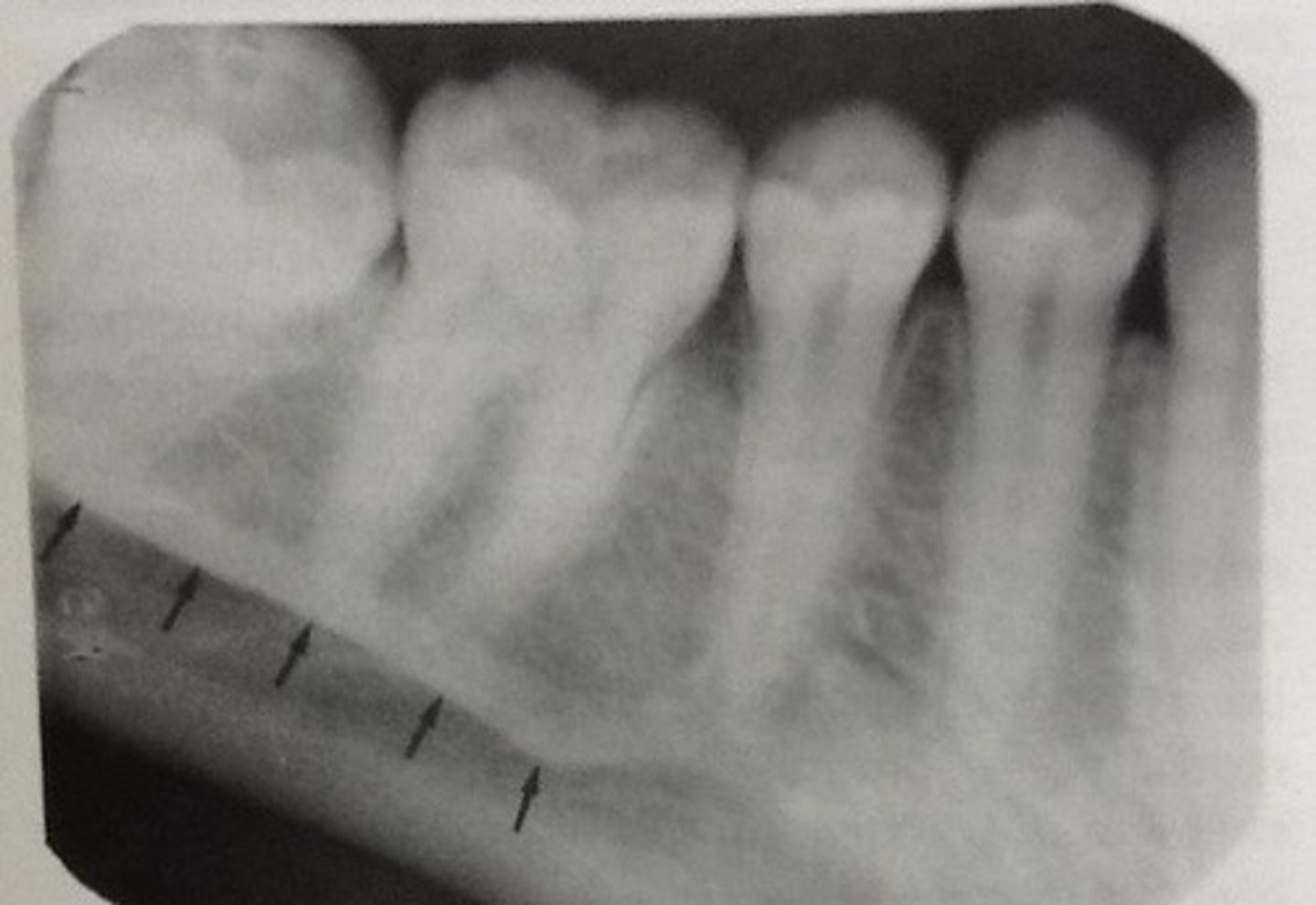 <p>Below apices of the molars</p>