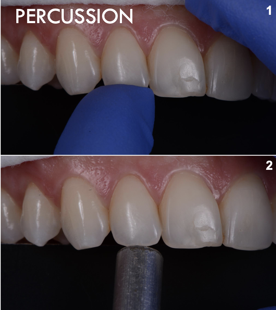 <p>Percussion test</p>