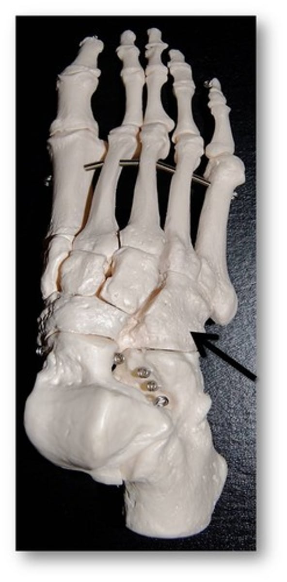 <p>Name this specific bone of the foot.</p>