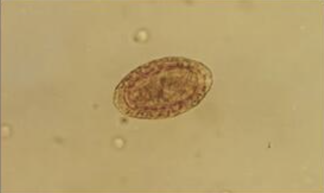 <p>ID the parasite egg</p>