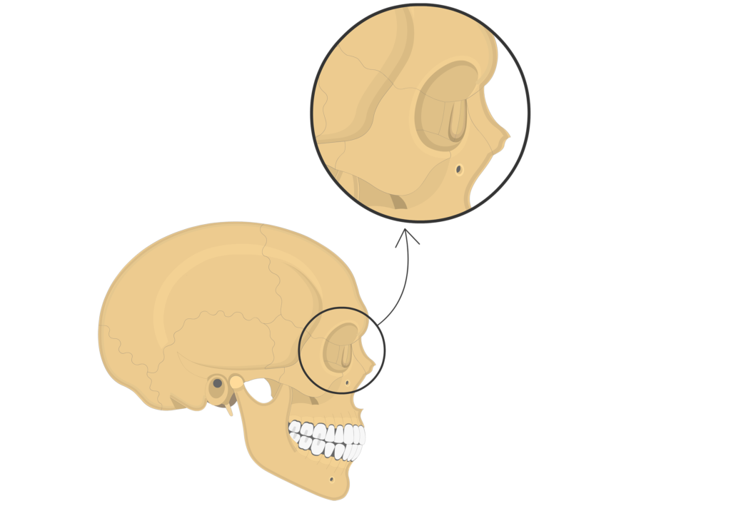 <p>lacrimal bones</p>