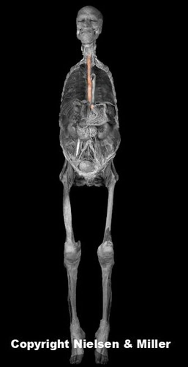 knowt flashcard image