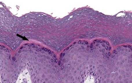 <p>“clear layer” </p><ul><li><p>found only in thick skin</p></li><li><p>translucency</p><ul><li><p>lack cellular components (organelles)</p></li></ul></li></ul>