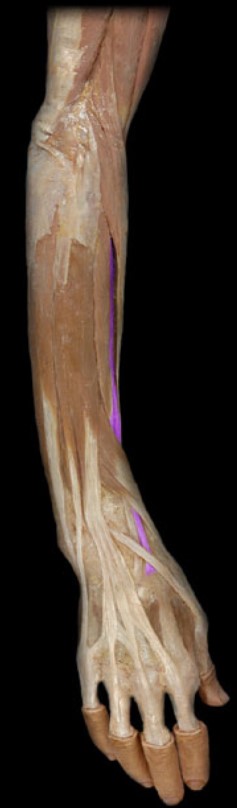 <p>Name the muscle highlighted (four words - all lowercase)</p>