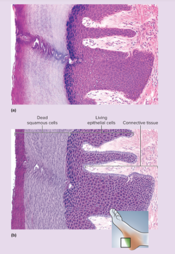 <p>multiple cell layers with cells becoming increasingly flat and scaly toward surface; surface covered with a layer of compact dead cells without nuclei; basal cells may be cuboidal to columnar</p>