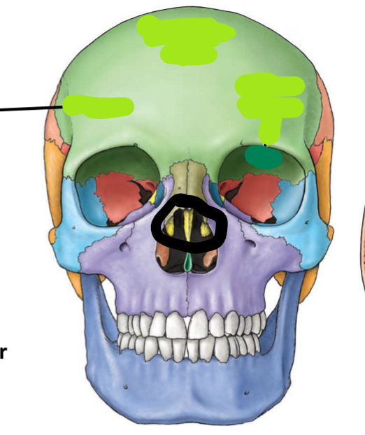 term image