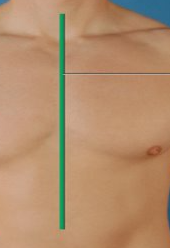 <p>exact middle (divides body into left and right)</p>