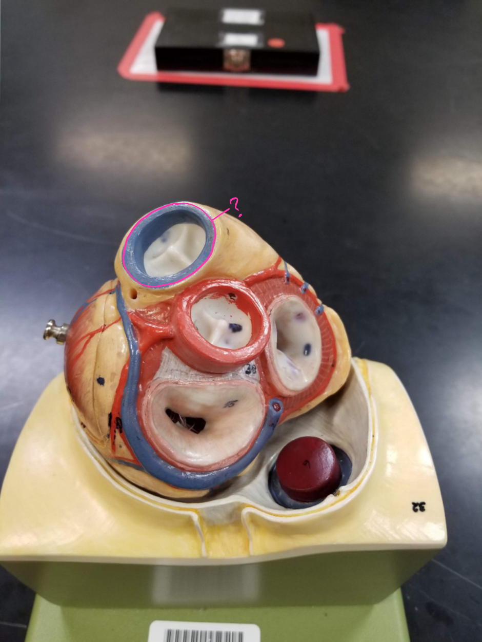 <p>what is outlined in pink?</p>