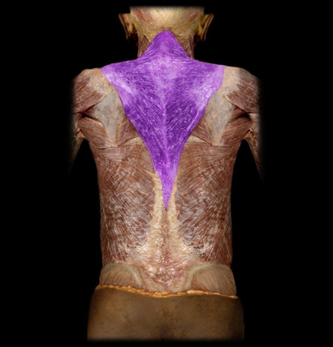<p>external occipital protuberance, medial portion of superior nuchal line of the occiput, ligamentum nuchae and spinous processes of c7-T12.</p>