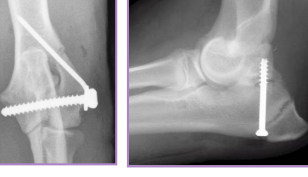 <p><span style="background-color: transparent;"><strong>Screws</strong></span></p>