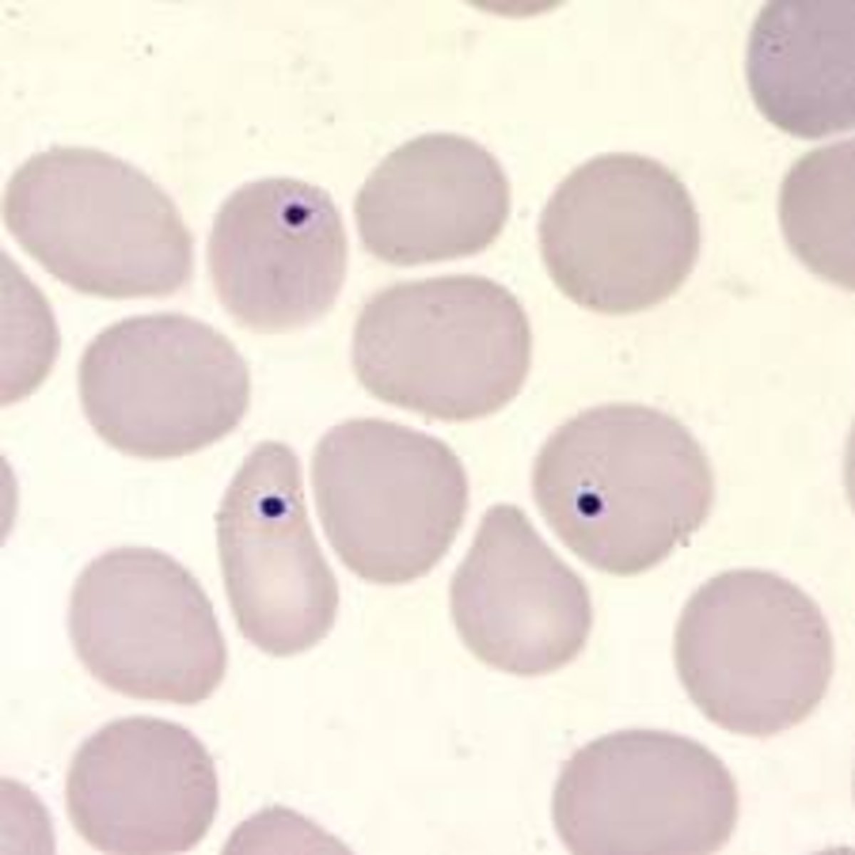 <p>Howell Jolly bodies</p>