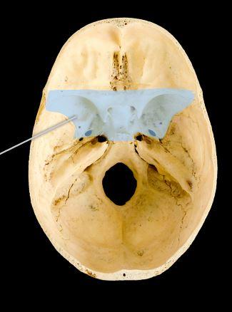<p>sphenoid bone</p>