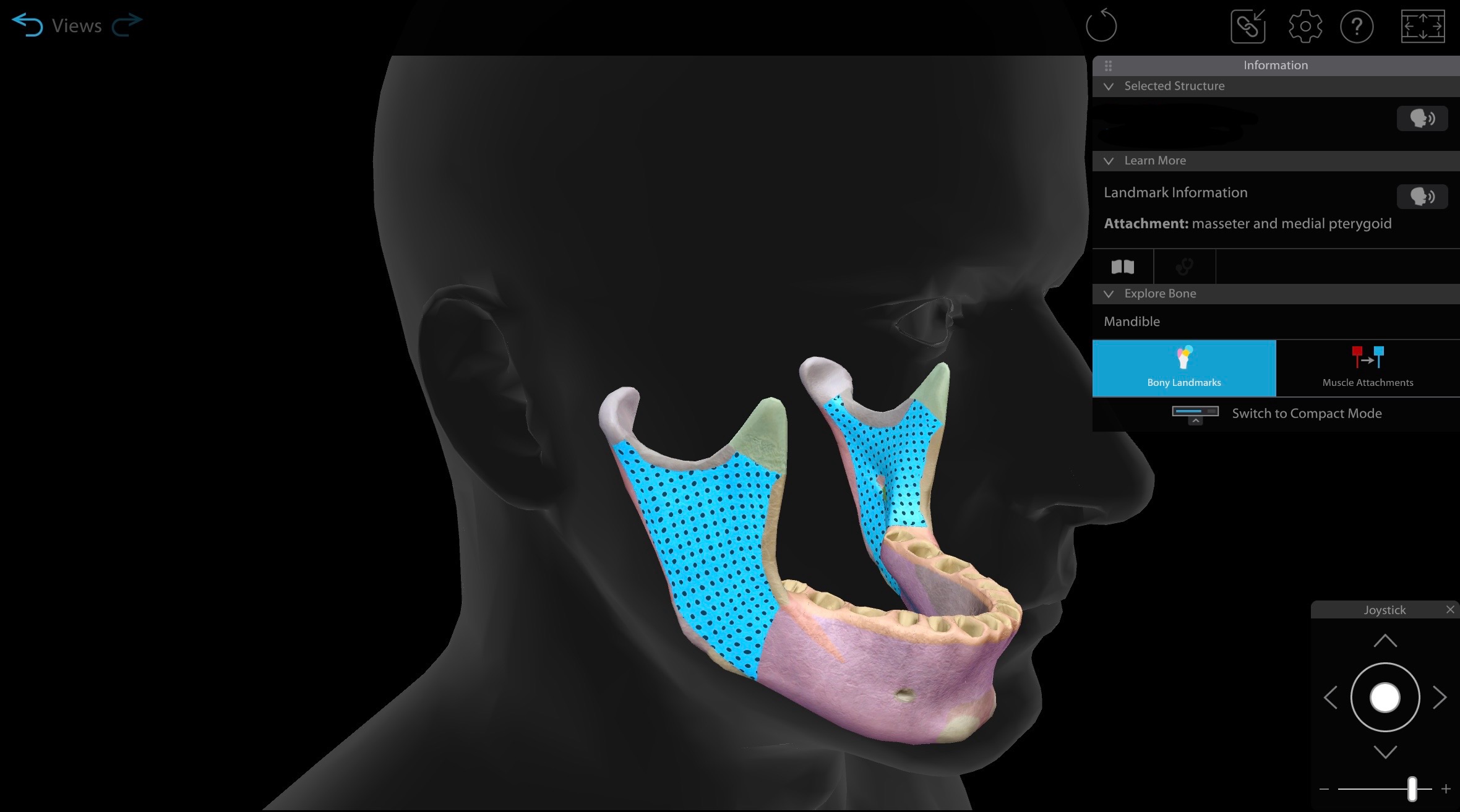 <p>Ramus of the mandible bone</p>