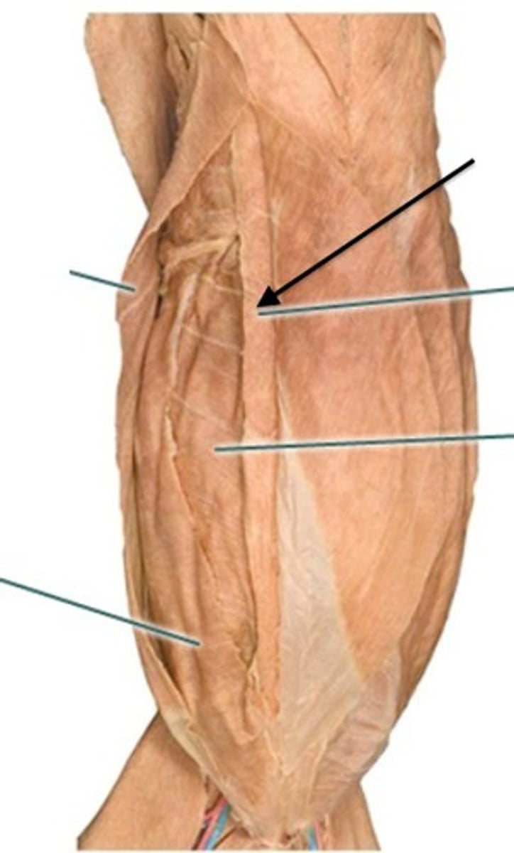 <p>what muscle is the arrow pointing to?</p>