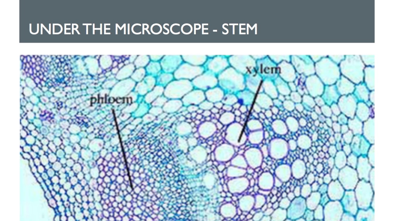 <p><strong>Xylem</strong></p>