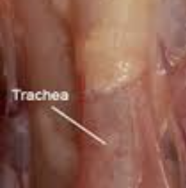 <p>transports air from larynx to bronchi</p>