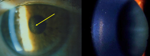 <p>identify </p>