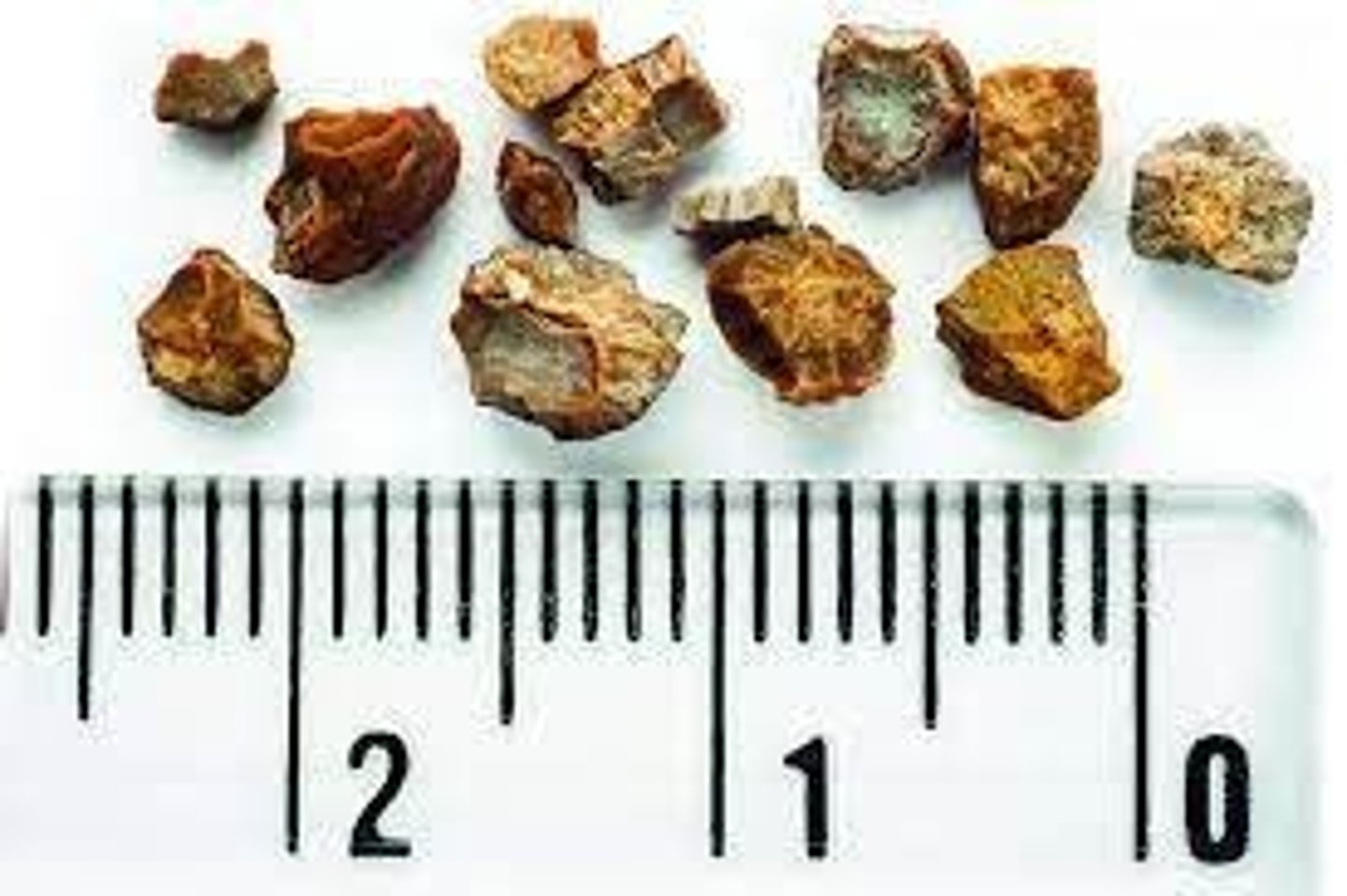 <p>Calcium Oxalate (50%), Calcium Phosphate (10-20%), Struvite (7%), and Cystine (3%)</p>