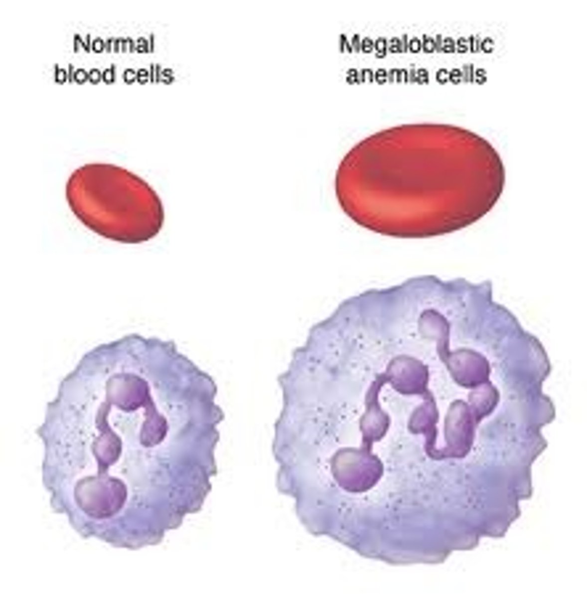 <p>red blood cells are larger than normal</p>