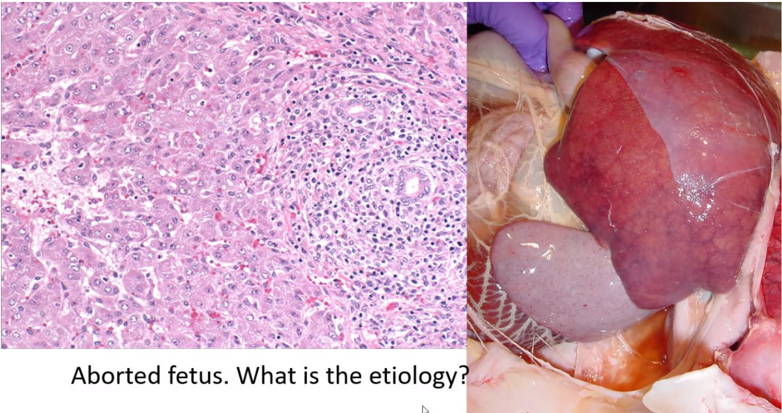 <p>Aborted fetus. What is the etiology?</p><p>1-Pajaelobacter abortibovis</p><p>2-Chlamydia bovis</p><p>3-Brucel/a abortus</p><p>4-Coxiella burnettii</p>