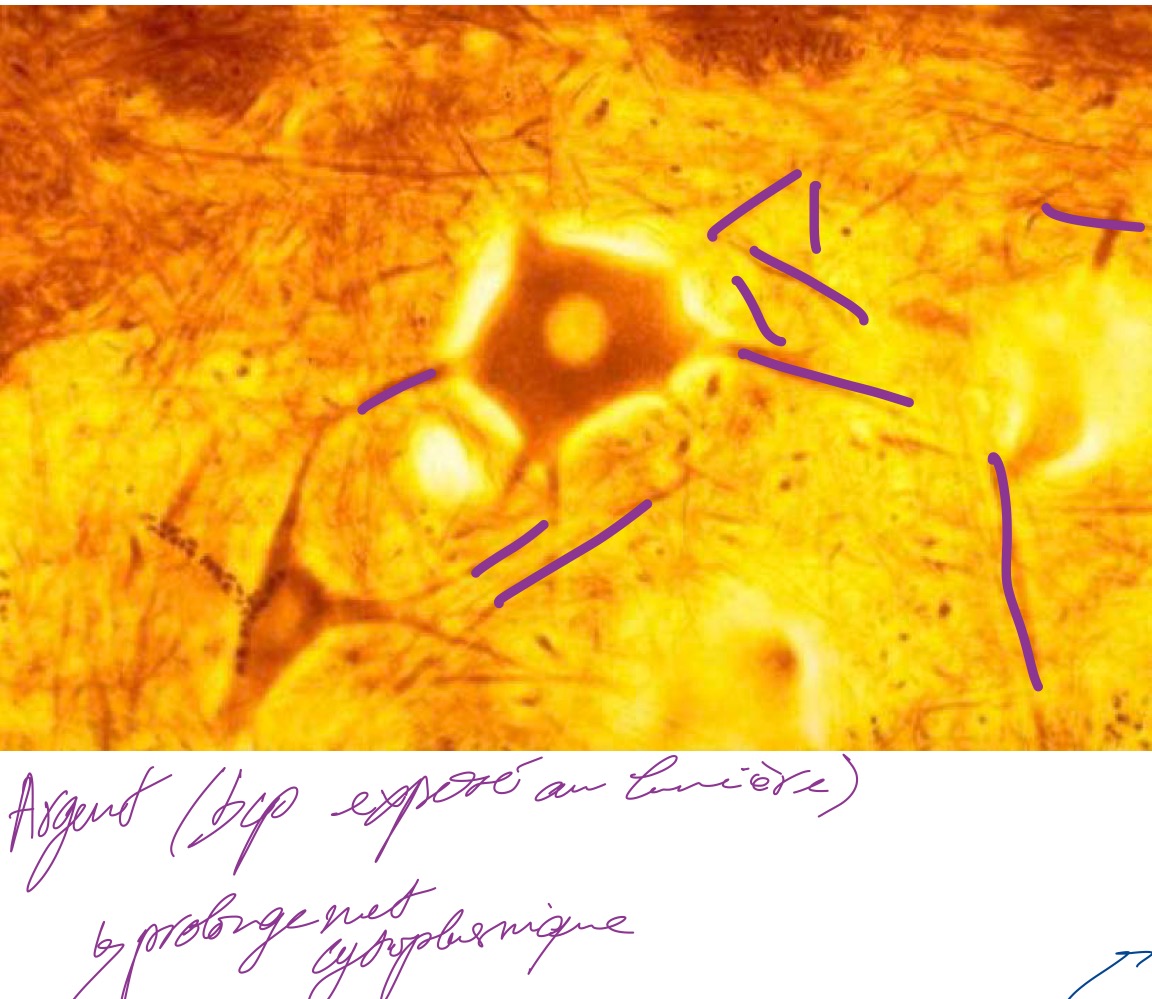<p>MO, paraffine, argent </p><p style="text-align: start">Neurites, prolongement cytoplasmique des neurones</p>