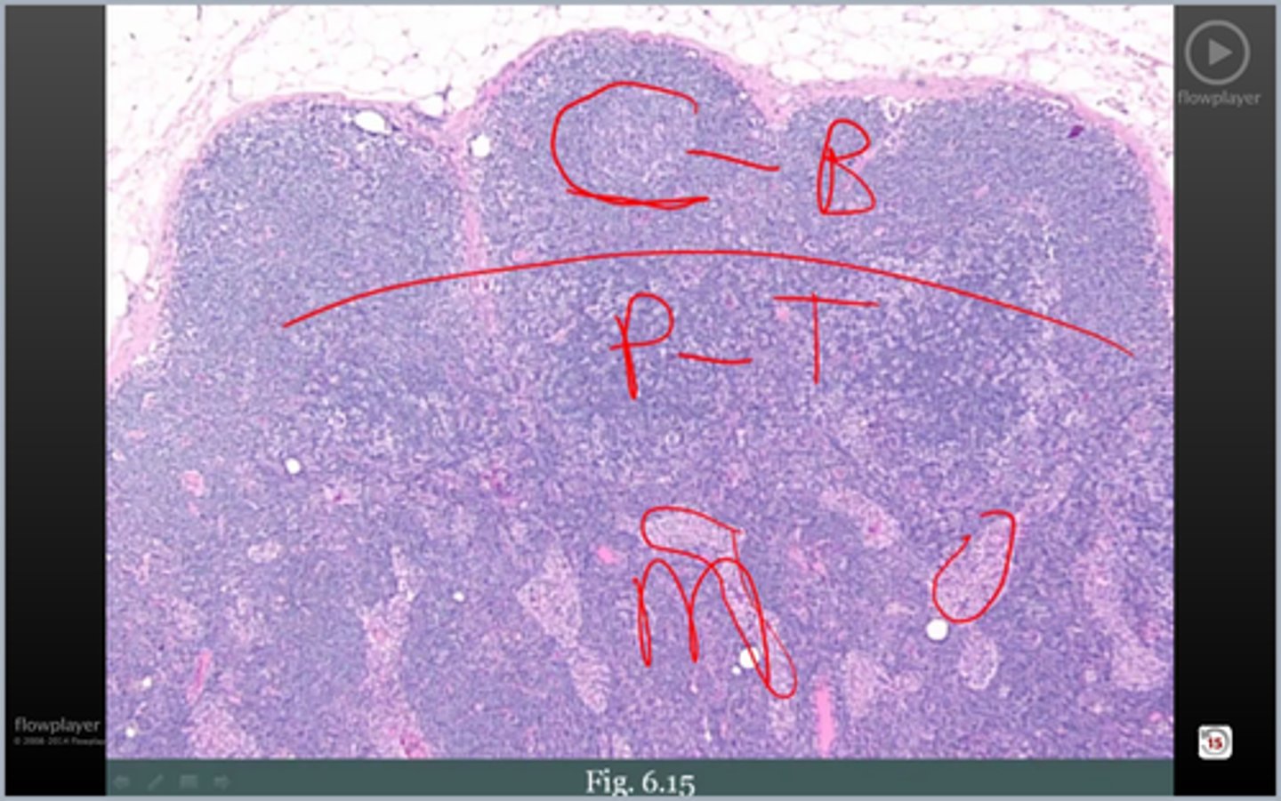 <p>what lymphoid tissue is this</p>