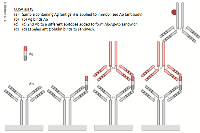 <ol><li><p>Sample containing Ag is applied to immobilized Ab</p></li><li><p>Ag binds Ab</p></li><li><p>2nd Ab to a different epitope added to form Ab-Ag sandwich</p></li><li><p>Labeled antiglobulin binds to sandwich</p></li></ol><p></p>
