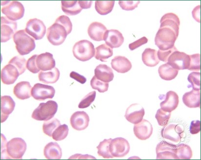 <p>What is in the center of this slide?</p>