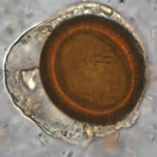 <p>Tapeworms that cause cestodiasis, transmitted via ingestion of infected meat, leading to mild digestive upset and cysticercosis.</p>