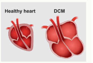 <ul><li><p>if the heart fills itself with more blood, it’s at an increasing mechanical disadvantage</p></li><li><p>chambers become more difficult to empty</p></li><li><p><strong>e.g. dilated cardiomyopathy</strong></p></li></ul><p></p>
