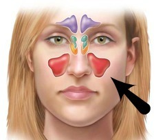 <p>largest paranasl sinus; pyramidal; on cheek bone lateral to nasal bone</p>