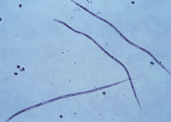 <p>What is the name of this&nbsp;parasitic<strong>&nbsp;</strong>larvae?</p>