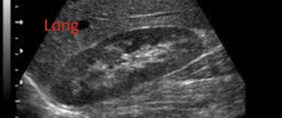 <p>Which type of kidney image is this?</p>