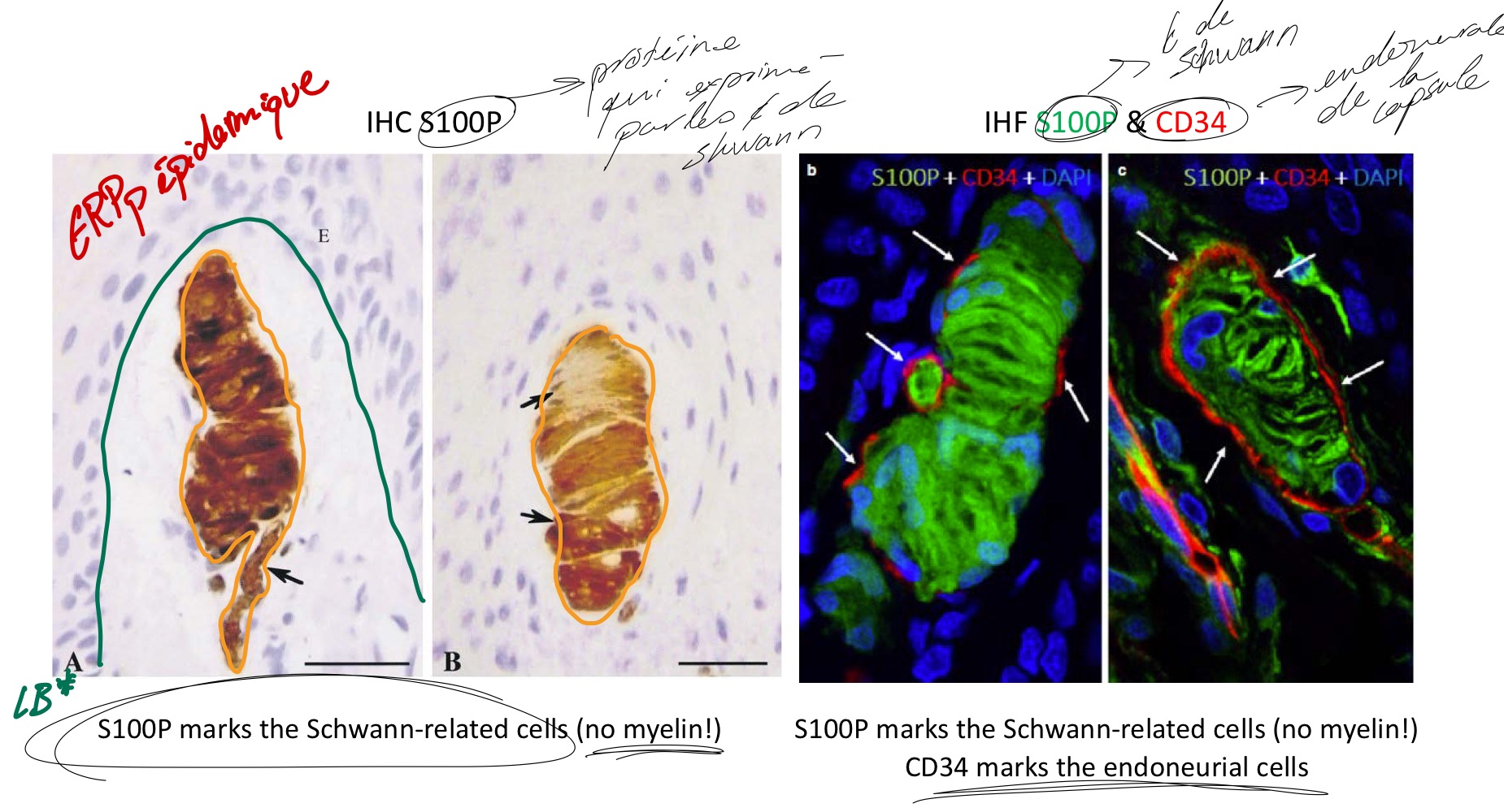 <p>IHC marque les cellules de schwann amyélisé</p><p>Terminaison nerveuse sensitive encapsulé sans support Corpuscule de Meissner </p>
