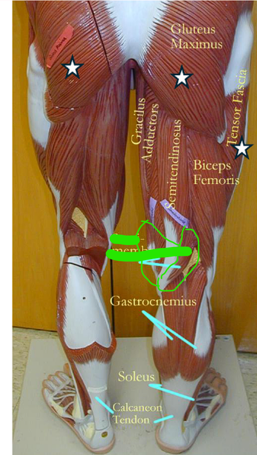 <ul><li><p>flexes the leg and extends the thigh </p></li></ul><p></p><ul><li><p>more closely attached to the <u>biceps femoris </u></p></li></ul><p></p>