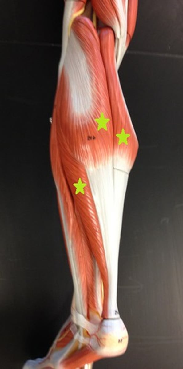 <p>plantar flex foot</p><p>•gastrocnemius</p><p>•soleus</p>
