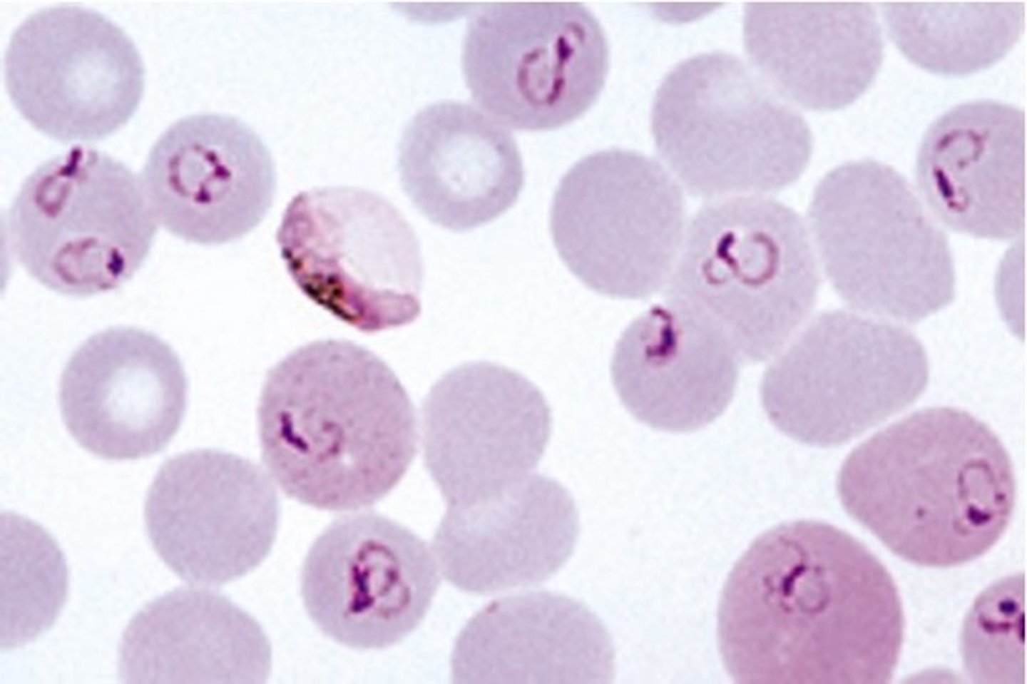 <p>has ring like structure (merozoite), and is intracellular parasite of blood cells</p>