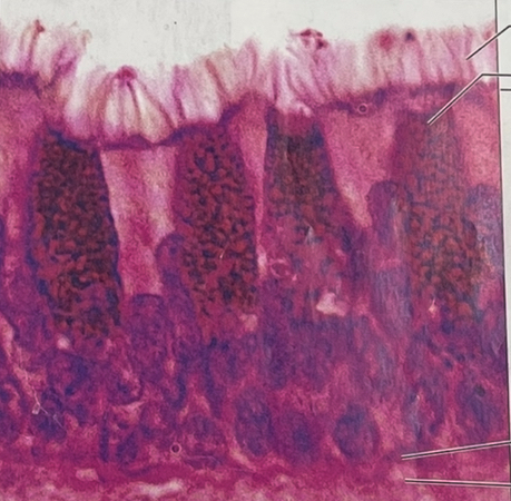 <p>Psedostratified columnar </p>